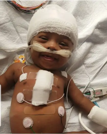Noah with a repaired heart, smiling after surgery